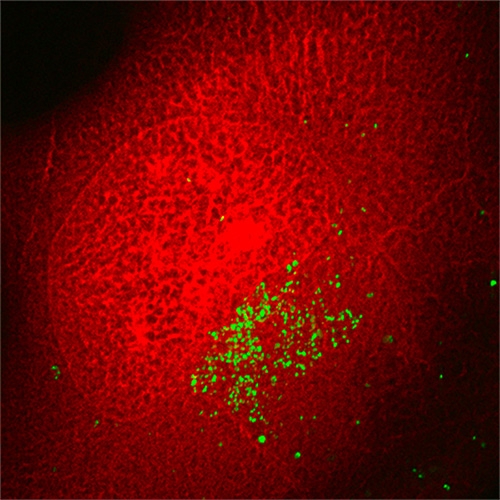 ICS | Distribution du manganèse (vert) et du potassium (rouge) d'une cellule exprimant une mutation impliquée dans une forme héréditaire de parkinsonisme.