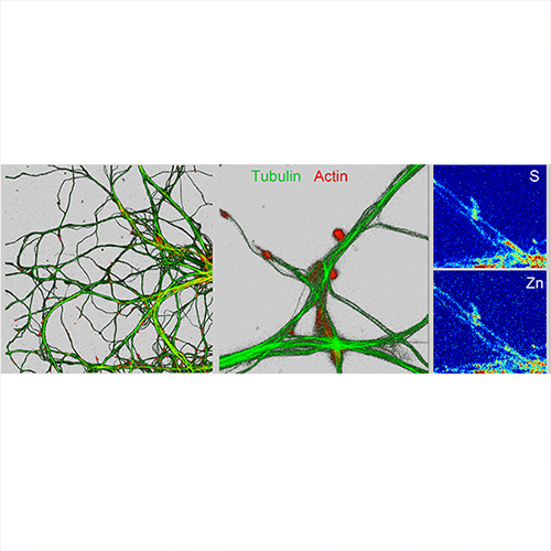ICS | Nano-imagerie de la tubuline et de l’actine, du soufre et du zinc, de dendrites et synapses de neurones de l’hippocampe