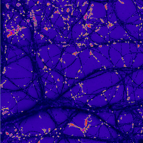 ICS | Nano-imagerie corrélative des protéines et des métaux dans les neurones©RichardOrtega