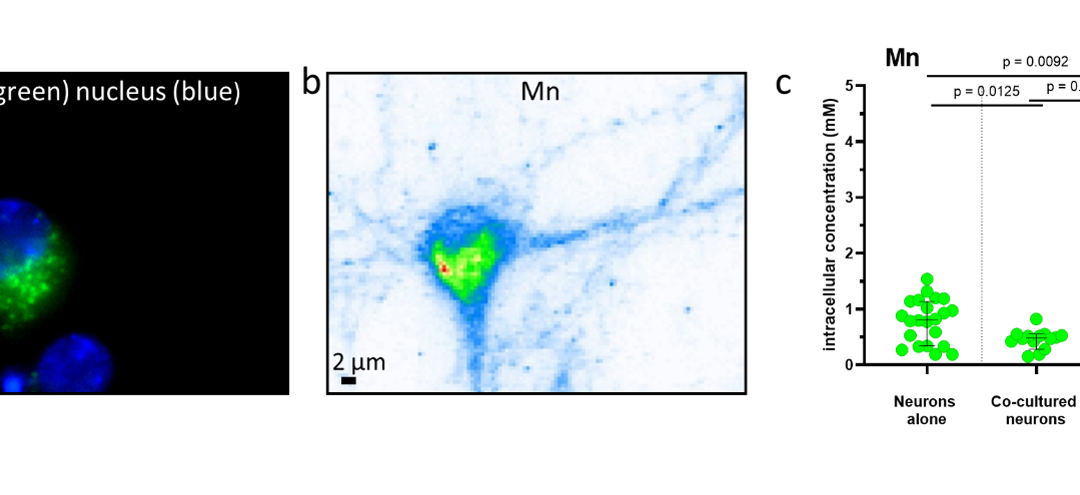 Des chercheurs du CNRS révèlent les mécanismes cellulaires de la neurotoxicité du manganèse 