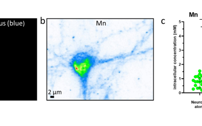 Des chercheurs du CNRS révèlent les mécanismes cellulaires de la neurotoxicité du manganèse